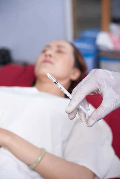 Purpose of the conversion