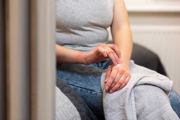 Preventing Escitalopram Cramps