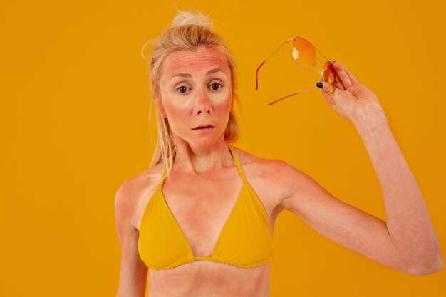 Side Effects of Fluoxetine